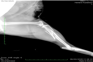chirurgie Orthopédique